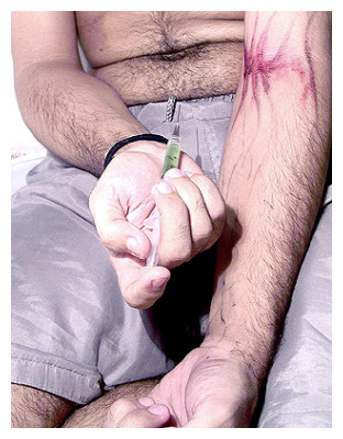 &iquest;Cu&aacute;les son los principales grupos de riesgo?